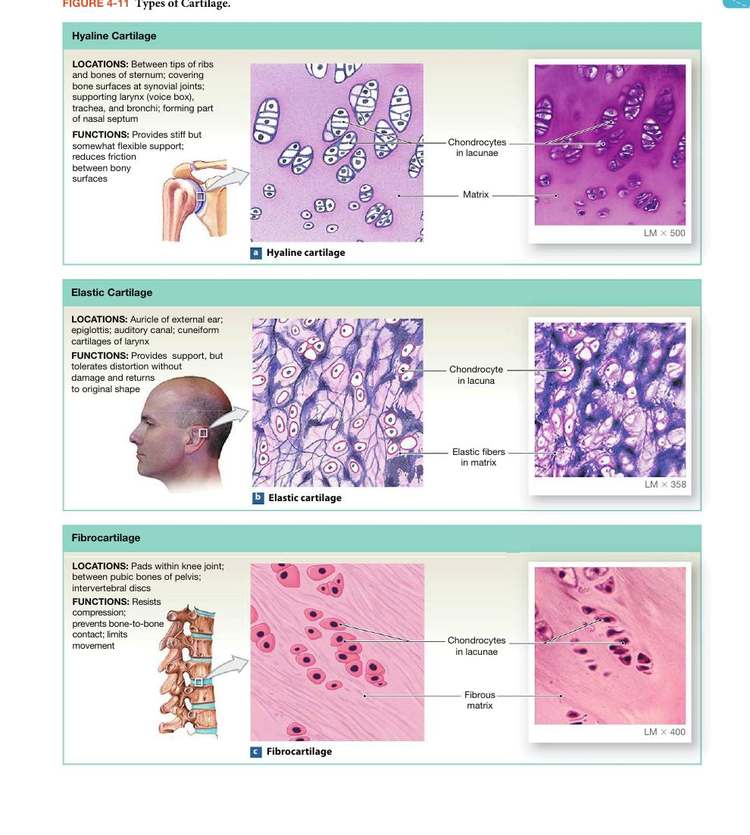 Figure 4-11: Types of Cartilage — hyaline, elastic, and fibrocartilage
